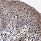 Immunohistochemical staining of human skin shows moderate granular cytoplasmic positivity in squamous epithelial cells.