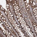 Immunohistochemical staining of human rectum shows moderate to granular cytoplasmic positivity in glandular cells.