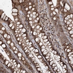 Immunohistochemical staining of human rectum shows moderate to granular cytoplasmic positivity in glandular cells.