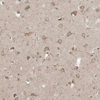 Immunohistochemical staining of human cerebral cortex shows moderate granular cytoplasmic positivity in neurons.