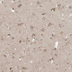 Immunohistochemical staining of human cerebral cortex shows moderate granular cytoplasmic positivity in neurons.