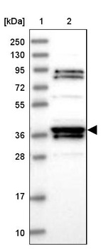Lane 1: Marker [kDa] 250, 130, 95, 72, 55, 36, 28, 17, 10_br/_Lane 2: Human cell line RT-4