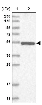 Lane 1: Marker [kDa] 230, 130, 95, 72, 56, 36, 28, 17, 11_br/_Lane 2: Human cell line RT-4