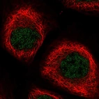 Immunofluorescent staining of human cell line A-431 shows localization to nucleoplasm.