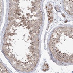 Immunohistochemical staining of human testis shows high expression.