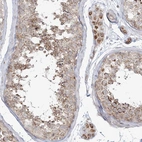 Immunohistochemical staining of human testis shows high expression.