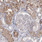 Immunohistochemical staining of human kidney shows moderate granular cytoplasmic positivity in cells in tubules.