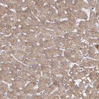 Immunohistochemical staining of human liver shows moderate granular cytoplasmic positivity in hepatocytes.