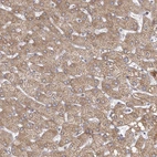 Immunohistochemical staining of human liver shows moderate granular cytoplasmic positivity in hepatocytes.