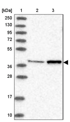 Lane 1: Marker [kDa] 250, 130, 95, 72, 55, 36, 28, 17, 10_br/_Lane 2: Human cell line RT-4_br/_Lane 3: Human cell line U-251MG sp