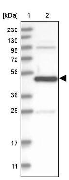 Lane 1: Marker [kDa] 230, 130, 95, 72, 56, 36, 28, 17, 11_br/_Lane 2: Human cell line RT-4