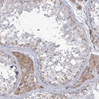 Immunohistochemical staining of human testis shows high expression.
