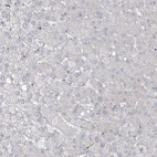 Immunohistochemical staining of human liver shows low expression as expected.