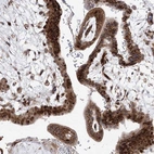 Anti-ARHGAP31 Antibody