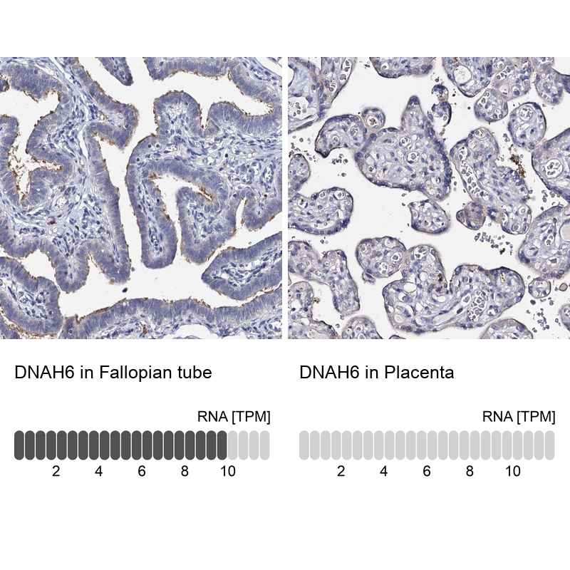 Anti-DNAH6 Antibody