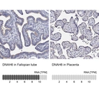 Anti-DNAH6 Antibody