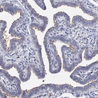 Immunohistochemical staining of human fallopian tube shows high expression.