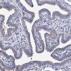 Immunohistochemical staining of human fallopian tube shows high expression.