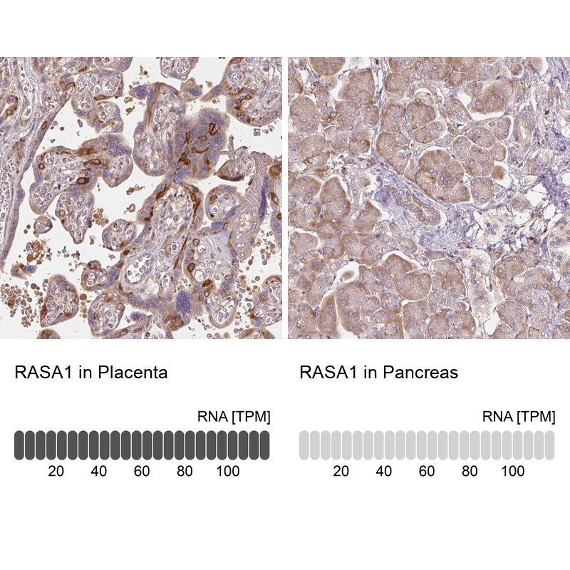 Anti-RASA1 Antibody