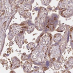 Anti-RASA1 Antibody