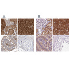 Immunohistochemical staining of human kidney, liver, small intestine and testis using Anti-HAAO antibody HPA036394 (A) shows similar protein distribution across tissues to independent antibody HPA042024 (B).