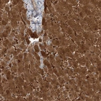 Immunohistochemical staining of human liver shows high expression.