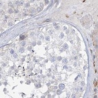 Immunohistochemical staining of human testis using Anti-HAAO antibody HPA036394.