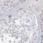 Immunohistochemical staining of human testis using Anti-HAAO antibody HPA036394.