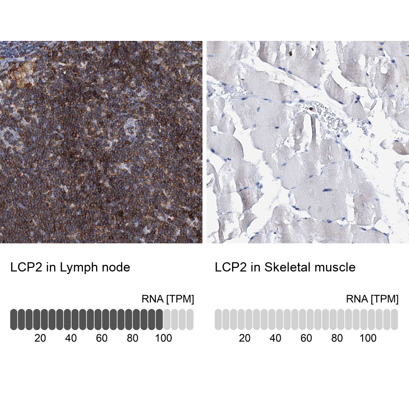 Anti-LCP2 Antibody