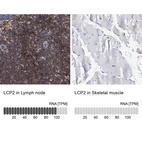 Anti-LCP2 Antibody