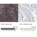 Anti-LCP2 Antibody