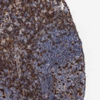 Immunohistochemical staining of human lymph node shows high expression.