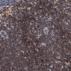 Immunohistochemical staining of human lymph node shows high expression.