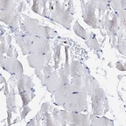 Immunohistochemical staining of human skeletal muscle shows low expression as expected.