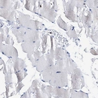 Immunohistochemical staining of human skeletal muscle shows low expression as expected.