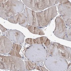 Immunohistochemical staining of human skeletal muscle shows low expression as expected.