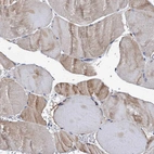 Immunohistochemical staining of human skeletal muscle shows low expression as expected.