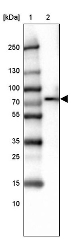 Anti-LCP2 Antibody