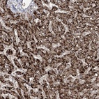 Anti-EHHADH Antibody