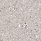 Immunohistochemical staining of human cerebral cortex shows low expression as expected.