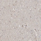 Immunohistochemical staining of human cerebral cortex shows low expression as expected.