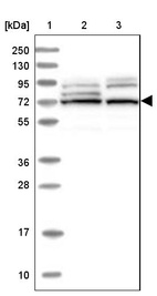 Lane 1: Marker [kDa] 250, 130, 95, 72, 55, 36, 28, 17, 10_br/_Lane 2: Human cell line RT-4_br/_Lane 3: Human cell line U-251MG sp