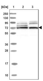 Lane 1: Marker [kDa] 250, 130, 95, 72, 55, 36, 28, 17, 10_br/_Lane 2: Human cell line RT-4_br/_Lane 3: Human cell line U-251MG sp