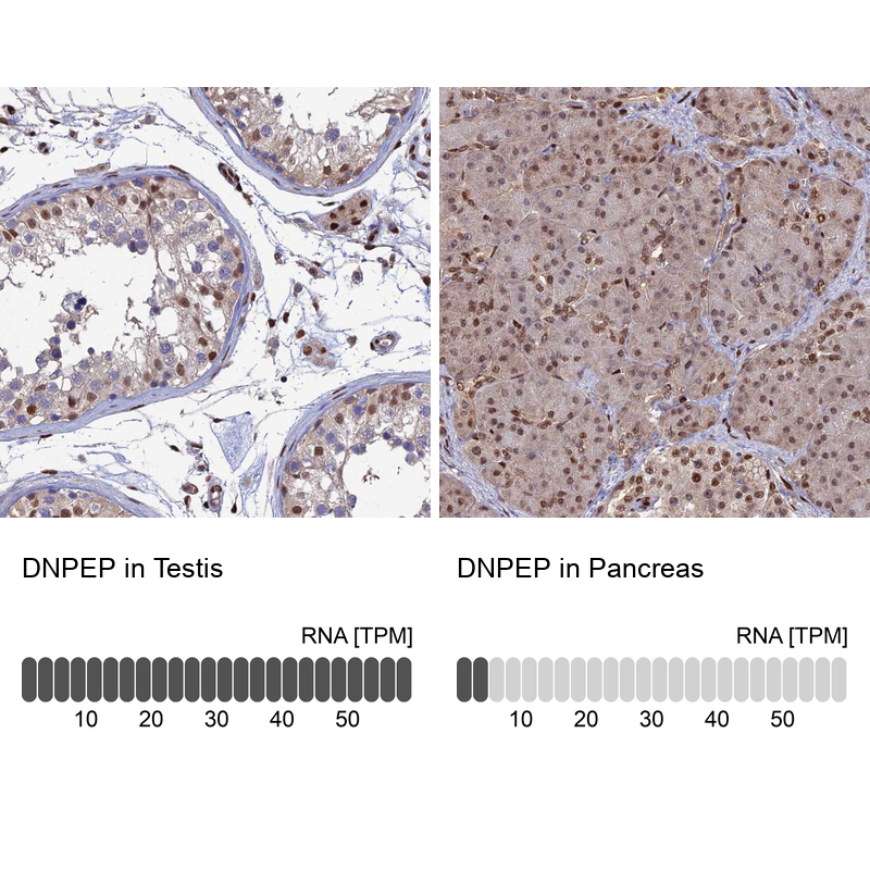 Anti-DNPEP Antibody