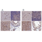 Immunohistochemical staining of human cerebral cortex, lymph node, pancreas and testis using Anti-DNPEP antibody HPA036398 (A) shows similar protein distribution across tissues to independent antibody HPA044860 (B).