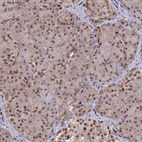 Immunohistochemical staining of human pancreas shows low expression as expected.