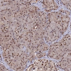 Immunohistochemical staining of human pancreas shows low expression as expected.