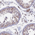 Immunohistochemical staining of human testis shows high expression.
