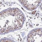 Immunohistochemical staining of human testis shows high expression.