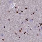 Immunohistochemical staining of human cerebral cortex using Anti-DNPEP antibody HPA036398.